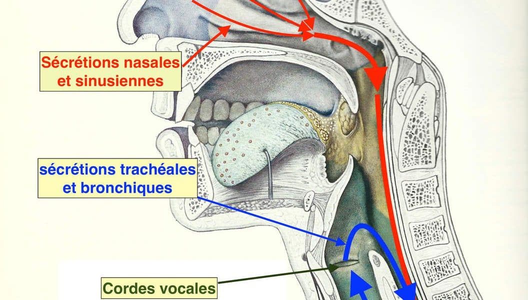 découvrez tout sur l'écoulement nasal postérieur, ses causes, symptômes et traitements. informez-vous sur cette condition commune pour mieux comprendre et gérer votre santé respiratoire.