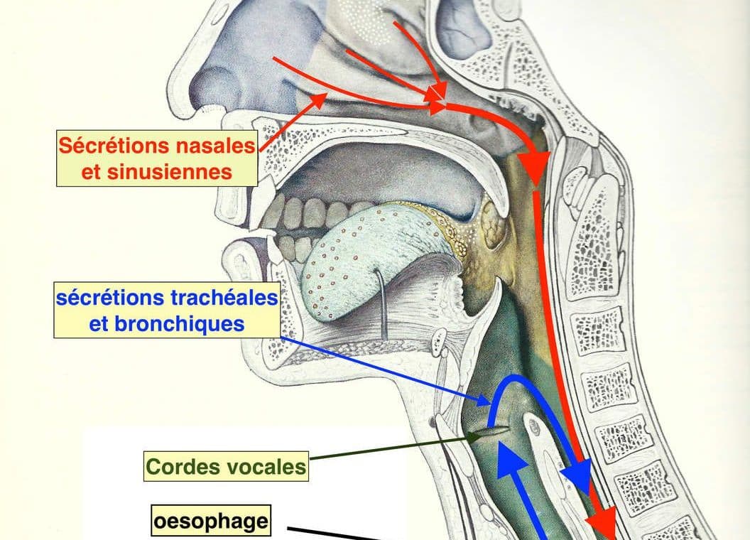 découvrez tout sur l'écoulement nasal postérieur, ses causes, symptômes et traitements. informez-vous sur cette condition commune pour mieux comprendre et gérer votre santé respiratoire.