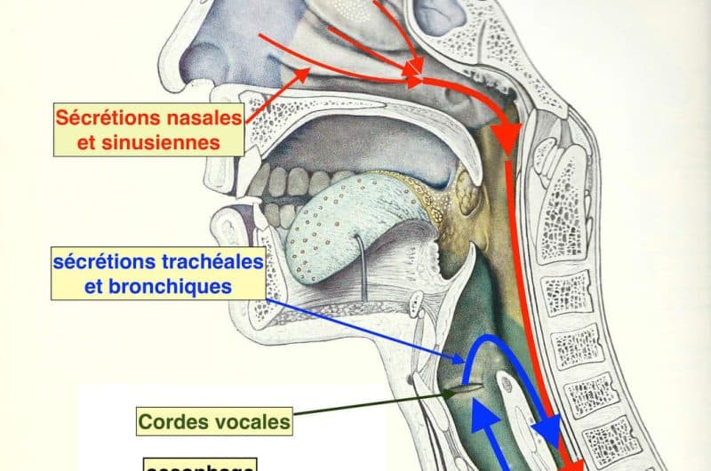 découvrez tout sur l'écoulement nasal postérieur, ses causes, symptômes et traitements. informez-vous sur cette condition commune pour mieux comprendre et gérer votre santé respiratoire.